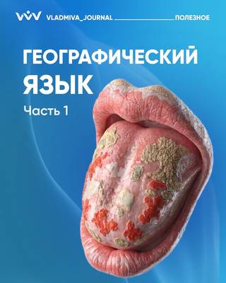 Географический язык: причины и особенности диагностики.